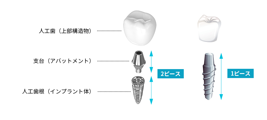 人工歯（上部構造物） 支台（アバットメント） 人工歯根（インプラント体）